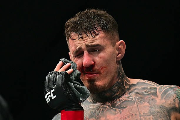 A tattooed UFC fighter, Tom Aspinall, emotionally wipes his bloody nose with a towel in his gloved hand after a fight.