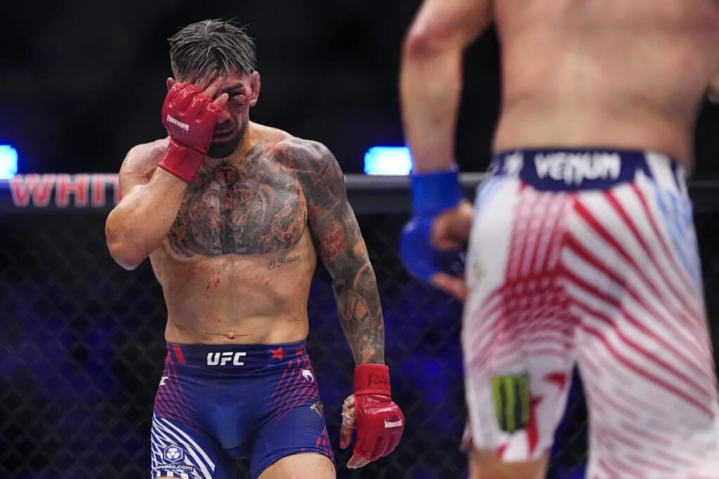 Ilia Topuria, rostro ensangrentado, se cubre el ojo con guante rojo tras una derrota UFC. Tatuajes en pecho. Gaethje al fondo.