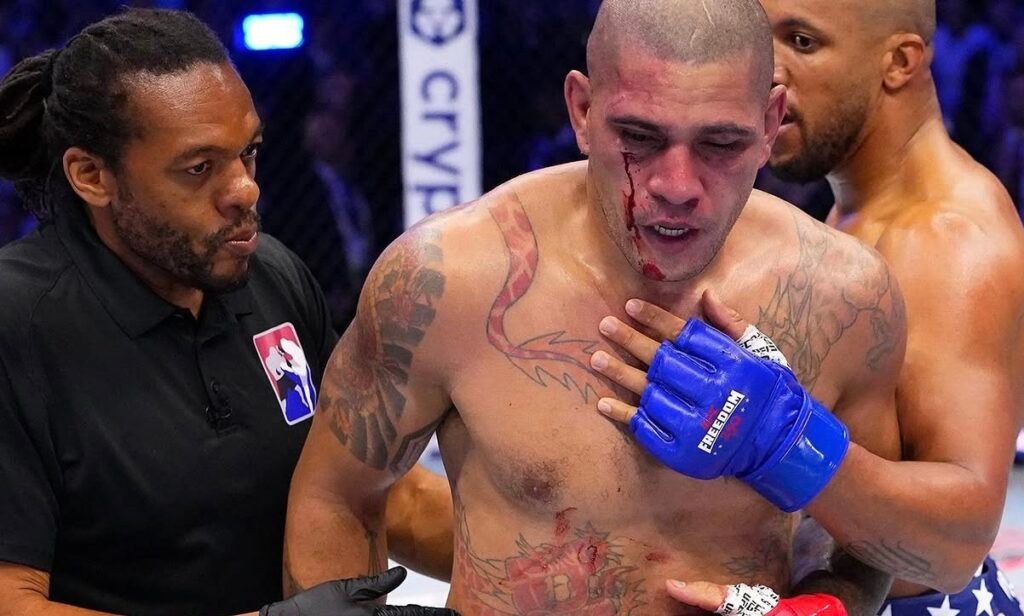 Alex Pereira, luchador de MMA, con la cara ensangrentada y el ojo hinchado, atendido por el árbitro tras un duro combate.