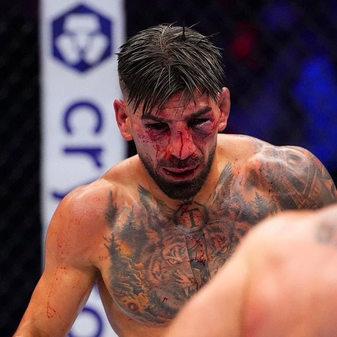 Luchador MMA con rostro ensangrentado, nariz rota y ojos morados. Sangre en tatuajes del pecho. Fondo: logo Crypto.com.