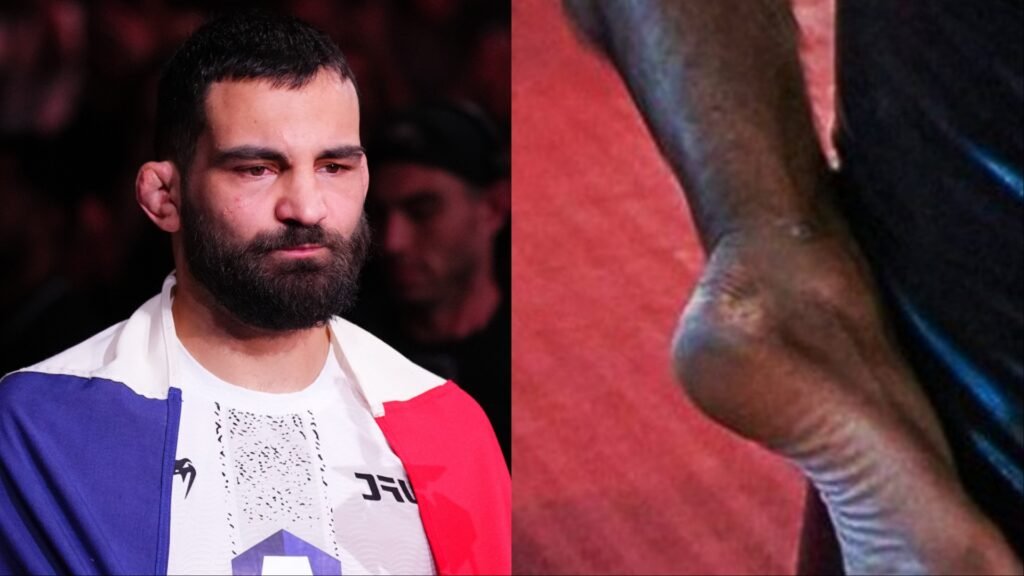 Luchador barbudo con oreja de coliflor y bandera francesa; a su lado, primer plano de un pie sobre lona roja.