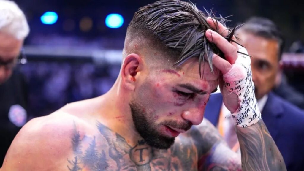 Luchador de la UFC con rostro ensangrentado y magullado, la mirada baja y mano en la cabeza, exhausto tras un intenso combate.